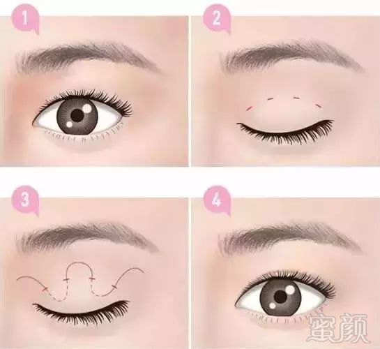 https://img.miyanlife.com/mnt/timg/180304/1024253Y9-2.jpg