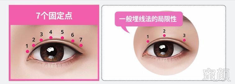 https://img.miyanlife.com/mnt/timg/180304/10242C239-3.jpg