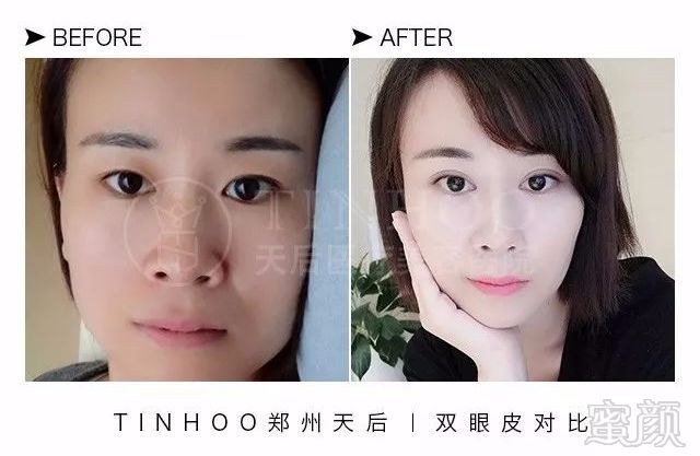 https://img.miyanlife.com/mnt/timg/180304/10242H458-7.jpg