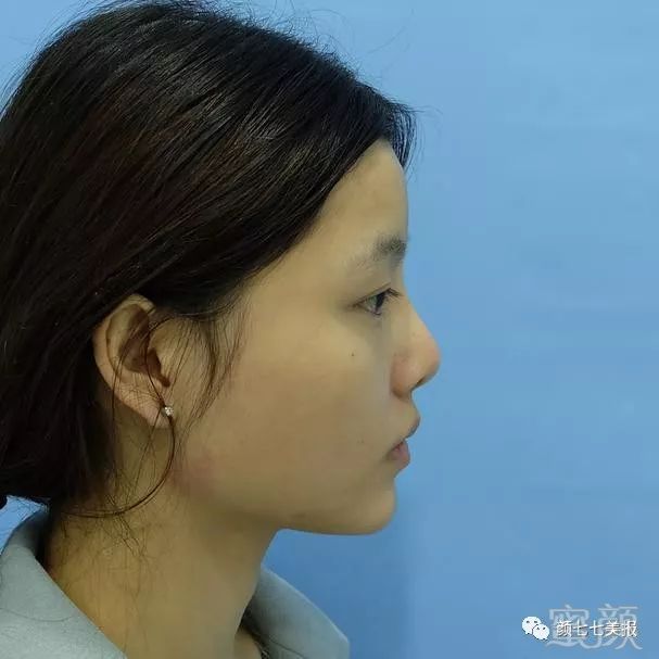 https://img.miyanlife.com/mnt/timg/180304/1039393U1-1.jpg
