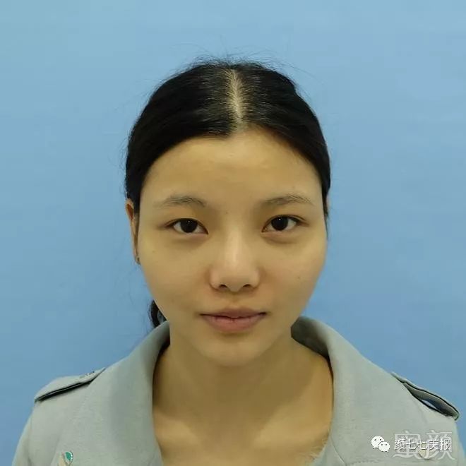 https://img.miyanlife.com/mnt/timg/180304/1039395154-0.jpg