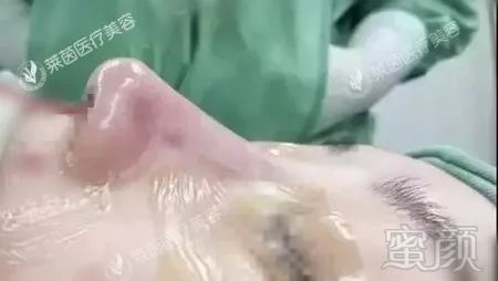 https://img.miyanlife.com/mnt/timg/180304/103A3A51-7.jpg