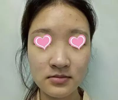 https://img.miyanlife.com/mnt/timg/180304/103A3G36-5.jpg