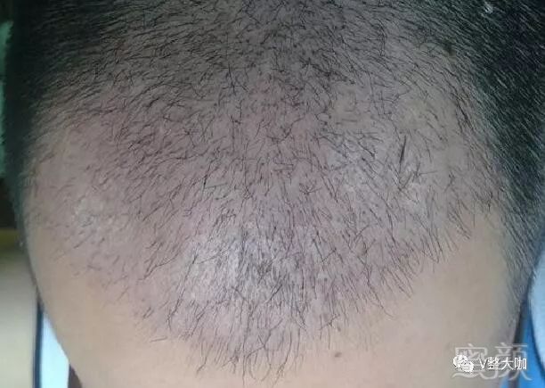 https://img.miyanlife.com/mnt/timg/180304/10455K142-3.jpg