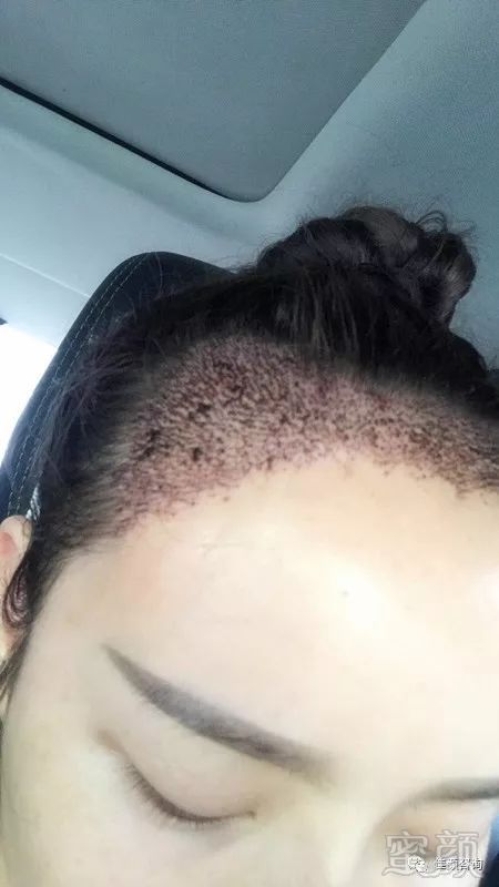 https://img.miyanlife.com/mnt/timg/180304/104624Oc-1.jpg