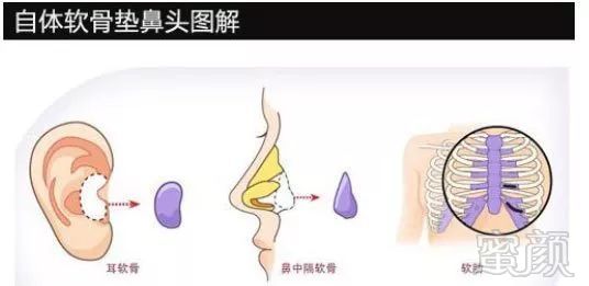 https://img.miyanlife.com/mnt/timg/180304/1054133151-2.jpg
