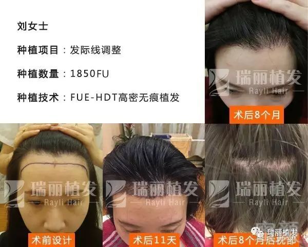 https://img.miyanlife.com/mnt/timg/180304/1102524R4-1.jpg