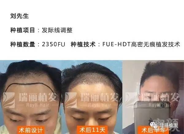 https://img.miyanlife.com/mnt/timg/180304/1102533117-2.jpg