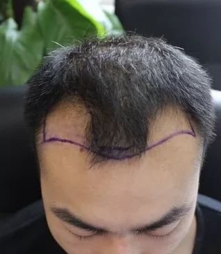https://img.miyanlife.com/mnt/timg/180304/1103436233-0.jpg