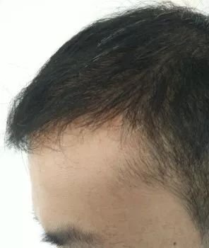 https://img.miyanlife.com/mnt/timg/180304/1103445X9-4.jpg