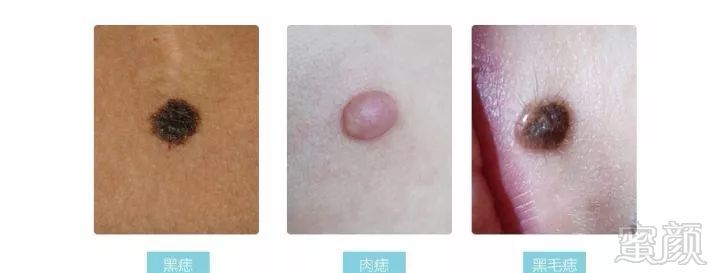 https://img.miyanlife.com/mnt/timg/180304/110I410A-2.jpg