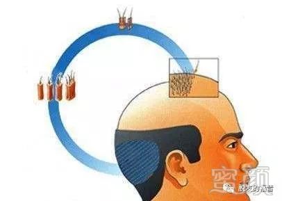 https://img.miyanlife.com/mnt/timg/180304/1111522Z6-1.jpg