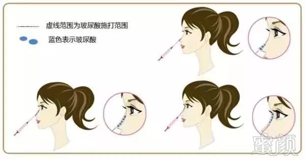 https://img.miyanlife.com/mnt/timg/180304/1114594116-1.jpg