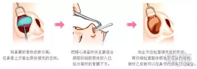 https://img.miyanlife.com/mnt/timg/180304/11150060T-3.jpg
