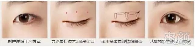 https://img.miyanlife.com/mnt/timg/180305/10364RF8-8.jpg