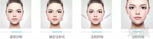 https://img.miyanlife.com/mnt/timg/180305/11024935E-3.jpg