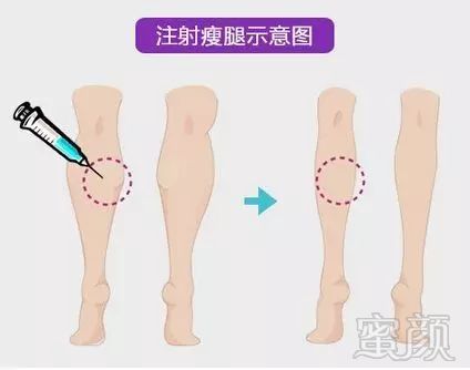 https://img.miyanlife.com/mnt/timg/180305/1102494001-6.jpg