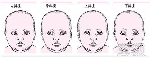 https://img.miyanlife.com/mnt/timg/180305/1102521014-8.jpg