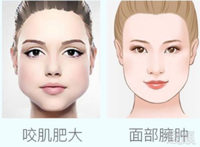 https://img.miyanlife.com/mnt/timg/180305/110U04314-2.jpg