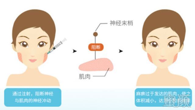 https://img.miyanlife.com/mnt/timg/180305/110U12911-6.jpg