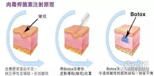https://img.miyanlife.com/mnt/timg/180305/11113W138-1.jpg