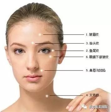 https://img.miyanlife.com/mnt/timg/180305/1111401358-6.jpg
