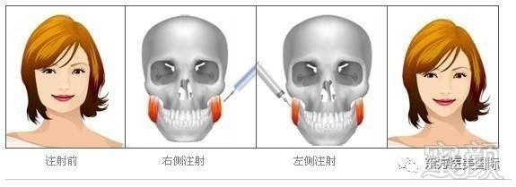 https://img.miyanlife.com/mnt/timg/180305/111140M96-4.jpg