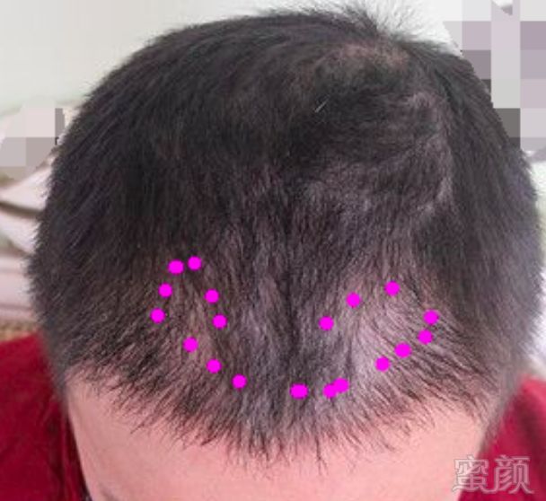 https://img.miyanlife.com/mnt/timg/180305/11322Q319-0.jpg