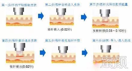 案例图片