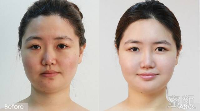 https://img.miyanlife.com/mnt/timg/180305/113504N30-0.jpg