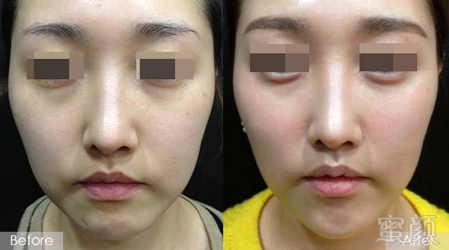 https://img.miyanlife.com/mnt/timg/180305/1135051643-2.jpg