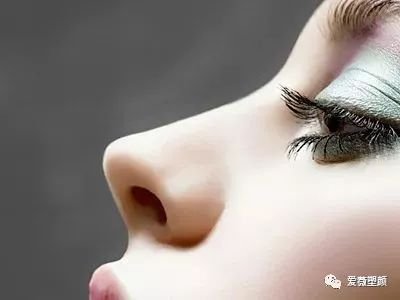 https://img.miyanlife.com/mnt/timg/180305/1145012c7-2.jpg