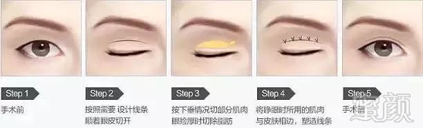 https://img.miyanlife.com/mnt/timg/180305/11531K445-10.jpg