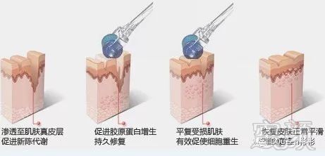 https://img.miyanlife.com/mnt/timg/180305/115J01X3-3.jpg