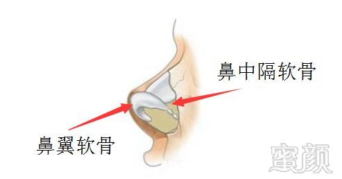 案例图片