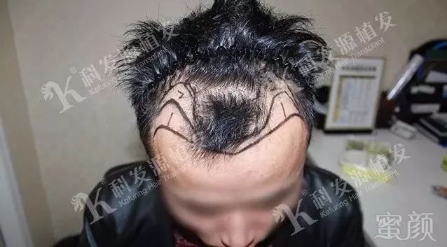 https://img.miyanlife.com/mnt/timg/180306/1039333H8-1.jpg