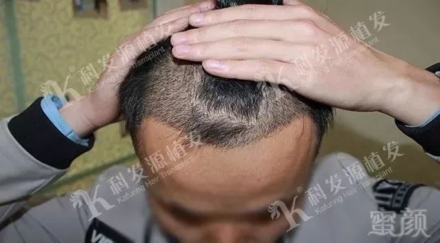 https://img.miyanlife.com/mnt/timg/180306/1039344F9-4.jpg