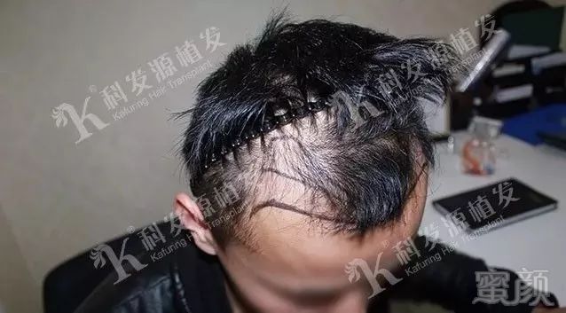 https://img.miyanlife.com/mnt/timg/180306/1039345W3-2.jpg