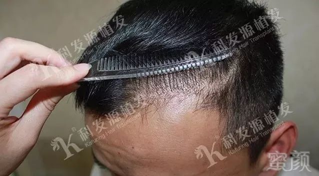 https://img.miyanlife.com/mnt/timg/180306/1039355429-9.jpg