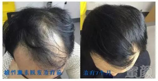 https://img.miyanlife.com/mnt/timg/180306/1051093512-11.jpg