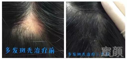 https://img.miyanlife.com/mnt/timg/180306/1051095N8-12.jpg