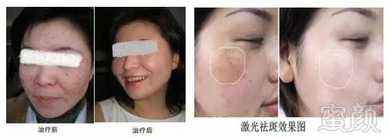 https://img.miyanlife.com/mnt/timg/180306/10510QD9-7.jpg