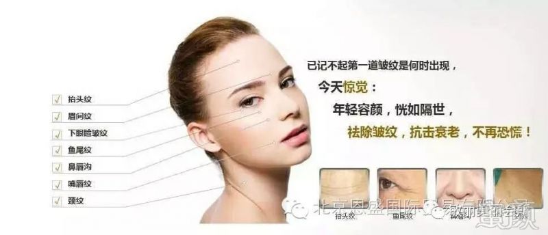 https://img.miyanlife.com/mnt/timg/180306/1053362348-0.jpg