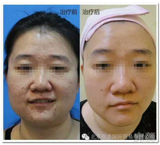https://img.miyanlife.com/mnt/timg/180306/10533961E-10.jpg