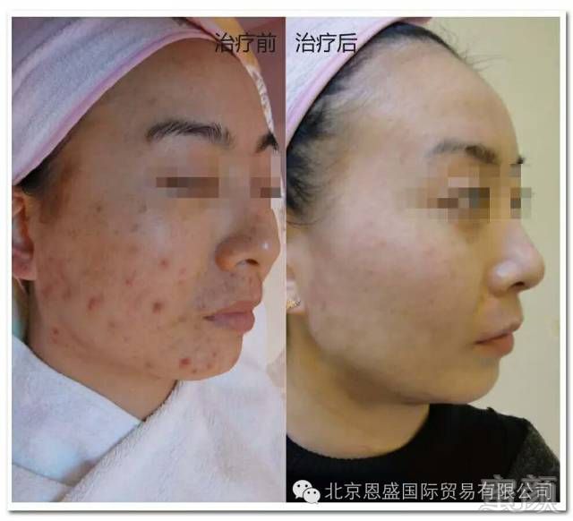 https://img.miyanlife.com/mnt/timg/180306/10533Q202-8.jpg
