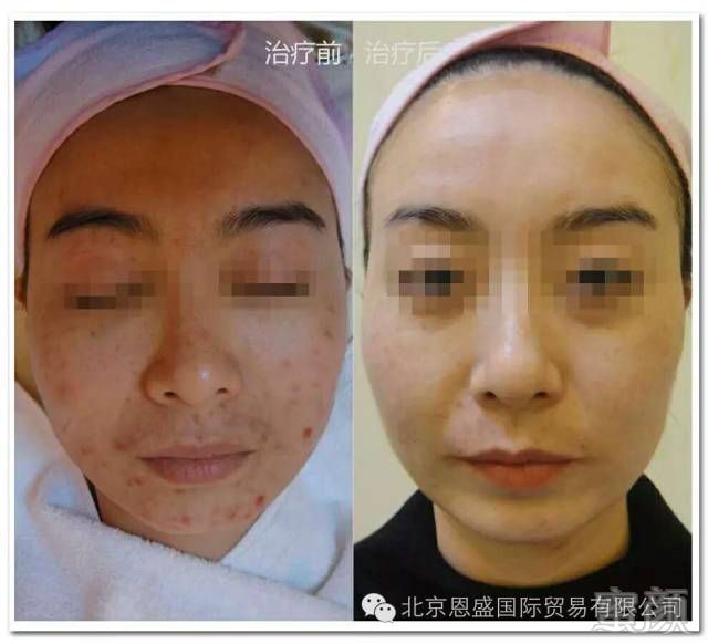 https://img.miyanlife.com/mnt/timg/180306/10533S409-9.jpg