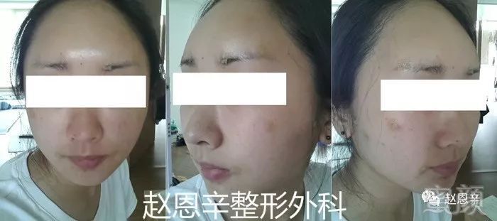 https://img.miyanlife.com/mnt/timg/180306/105U31255-2.jpg