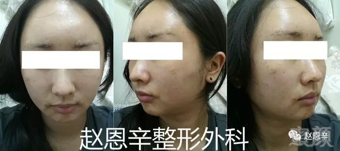 https://img.miyanlife.com/mnt/timg/180306/105U31510-1.jpg