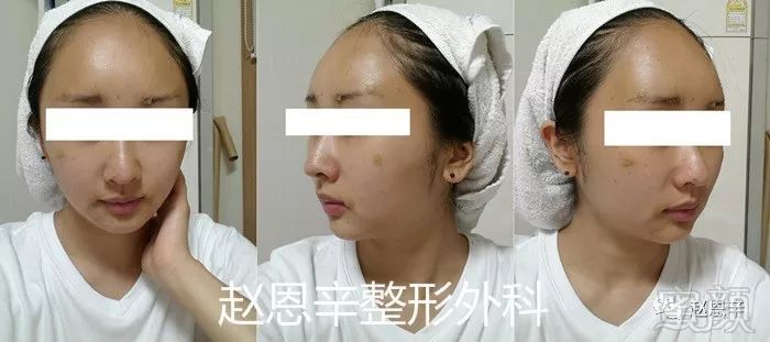 https://img.miyanlife.com/mnt/timg/180306/105U42O6-3.jpg