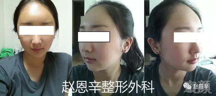 https://img.miyanlife.com/mnt/timg/180306/105U43161-4.jpg
